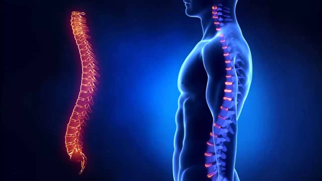 Osteochondróza je klasifikována podle částí páteře, ve kterých se onemocnění vyvíjí.